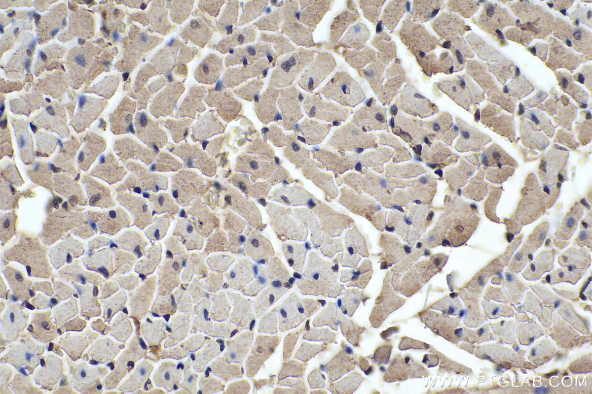 Immunohistochemical analysis of paraffin-embedded rat heart tissue slide using KHC0329 (FBXO32 IHC Kit).