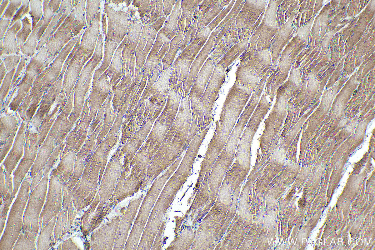 Immunohistochemical analysis of paraffin-embedded rat skeletal muscle tissue slide using KHC0329 (FBXO32 IHC Kit).