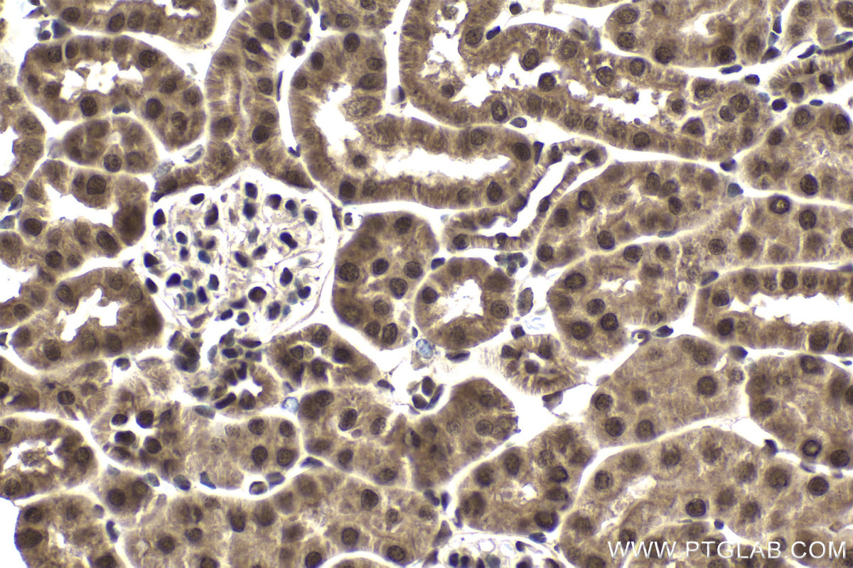 Immunohistochemical analysis of paraffin-embedded mouse kidney tissue slide using KHC1994 (FBXO5 IHC Kit).