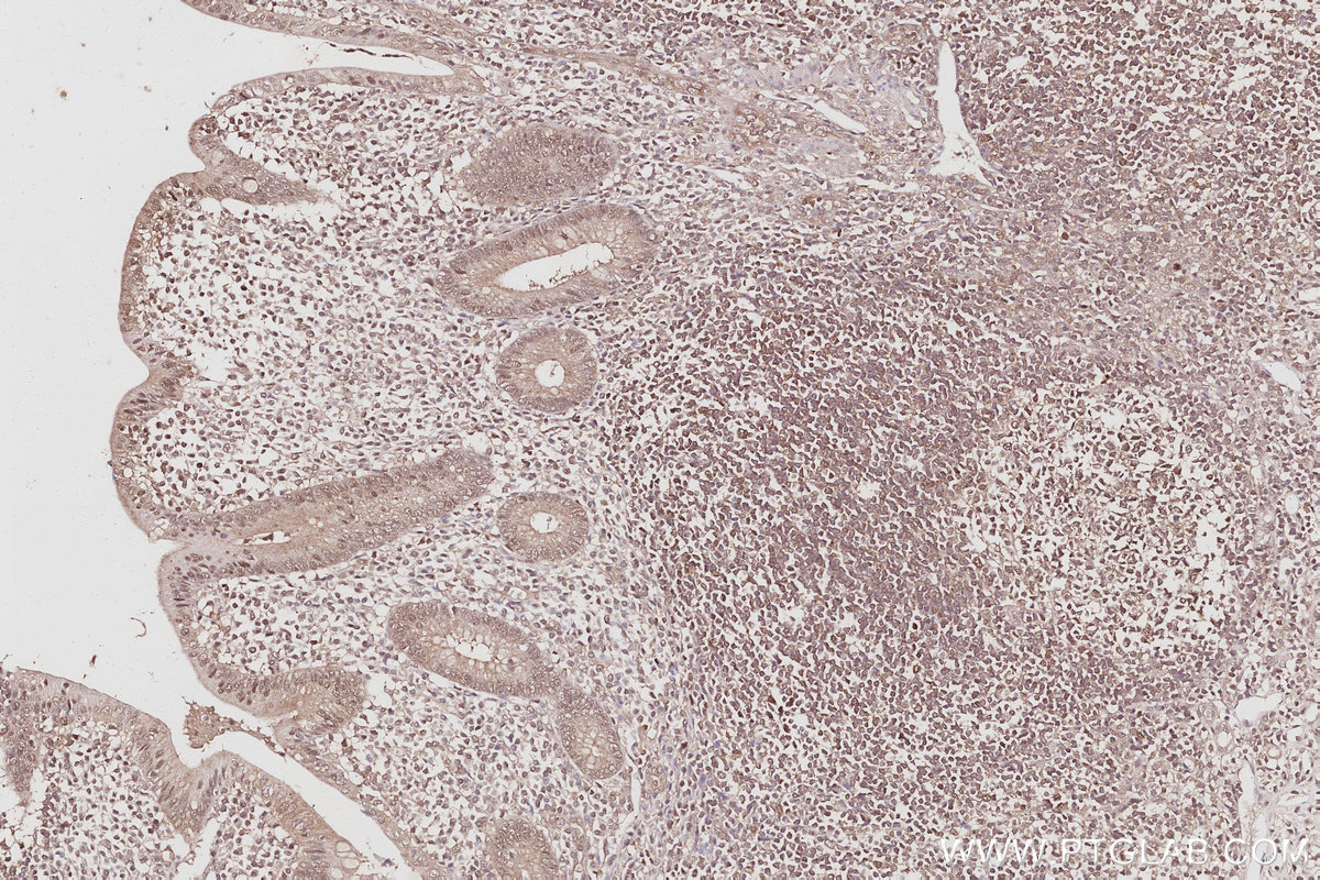 Immunohistochemical analysis of paraffin-embedded human appendicitis tissue slide using KHC3063 (FBXO7 IHC Kit). Immunohistochemical analysis of paraffin-embedded human appendicitis tissue slide using KHC3063 (FBXO7 IHC Kit).