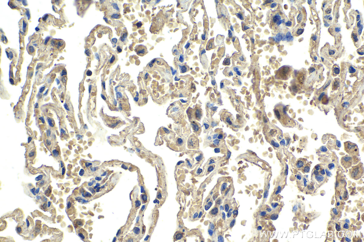 Immunohistochemical analysis of paraffin-embedded human lung tissue slide using KHC1989 (FBXW11 IHC Kit).