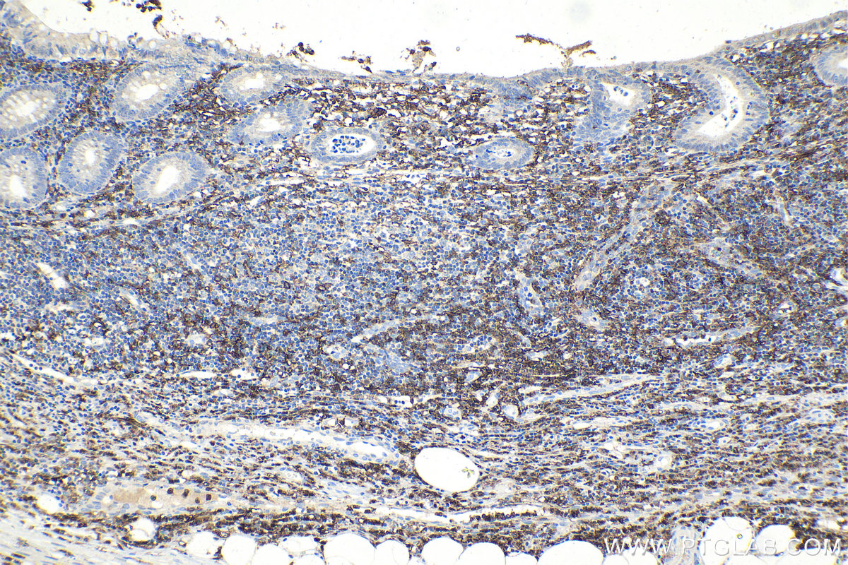 Immunohistochemical analysis of paraffin-embedded human appendicitis tissue slide using KHC0941 (FCGR2A/CD32A IHC Kit).
