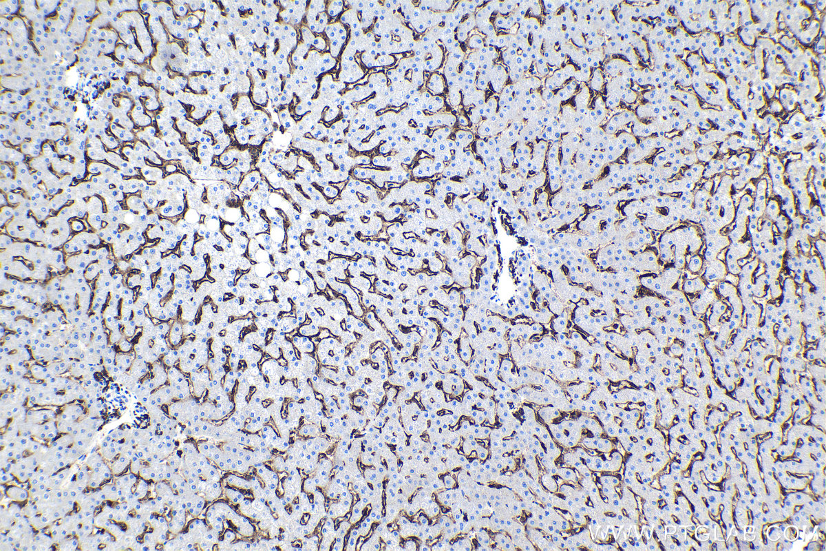 Immunohistochemical analysis of paraffin-embedded human liver tissue slide using KHC0941 (FCGR2A/CD32A IHC Kit).