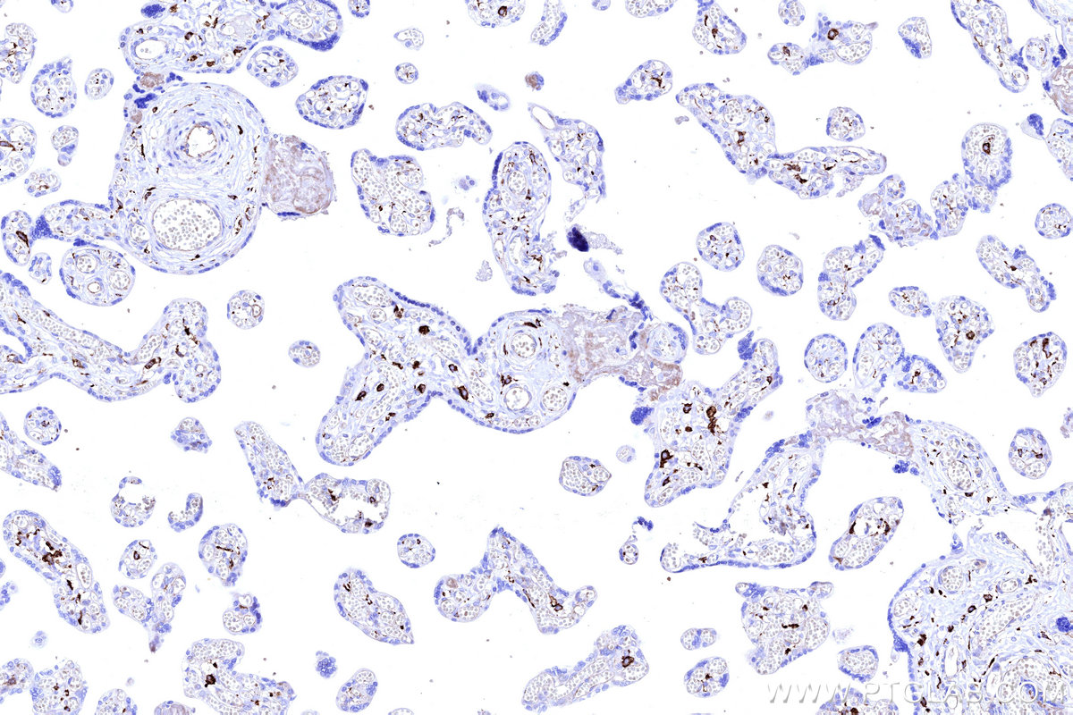 Immunohistochemical analysis of paraffin-embedded human placenta tissue slide using KHC3232 (FCGRT/FCRN IHC Kit).