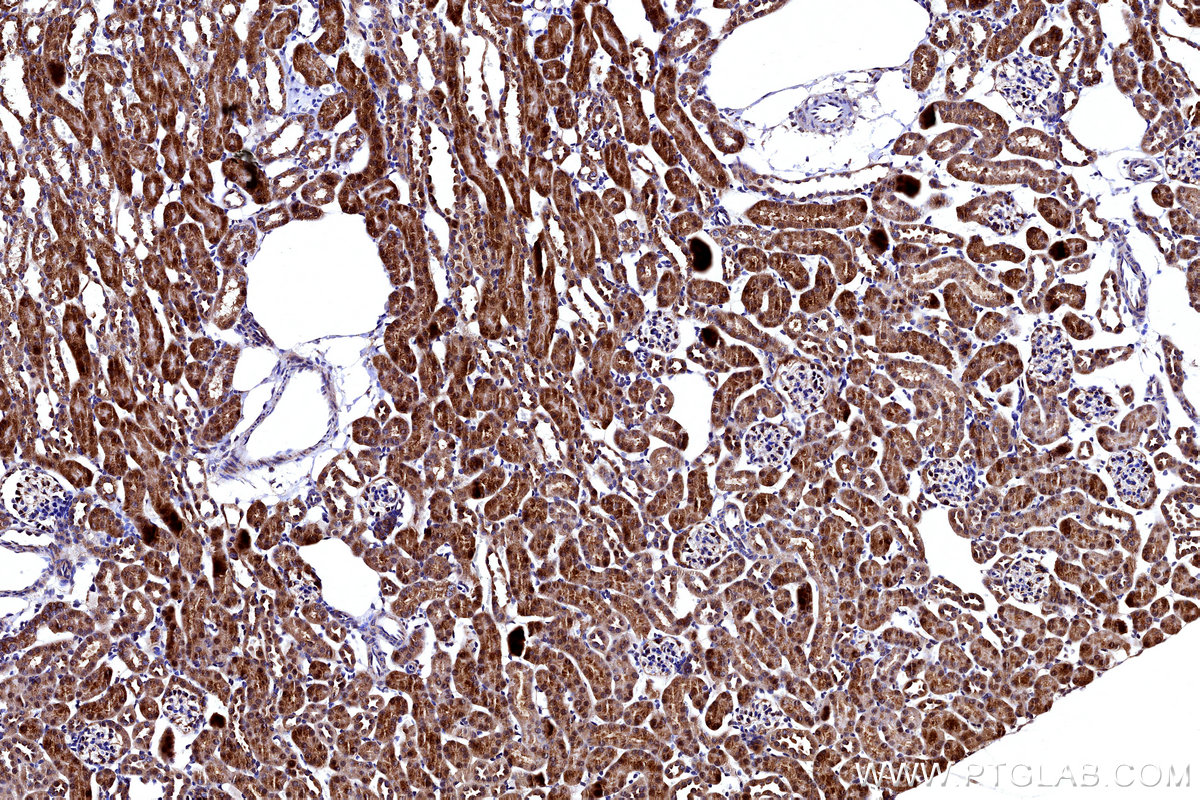 Immunohistochemical analysis of paraffin-embedded mouse kidney tissue slide using KHC3175 (FDX1 IHC Kit). Immunohistochemical analysis of paraffin-embedded mouse kidney tissue slide using KHC3175 (FDX1 IHC Kit).