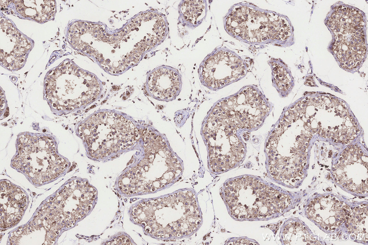 Immunohistochemical analysis of paraffin-embedded human testis tissue slide using KHC3271 (FDX1L IHC Kit).