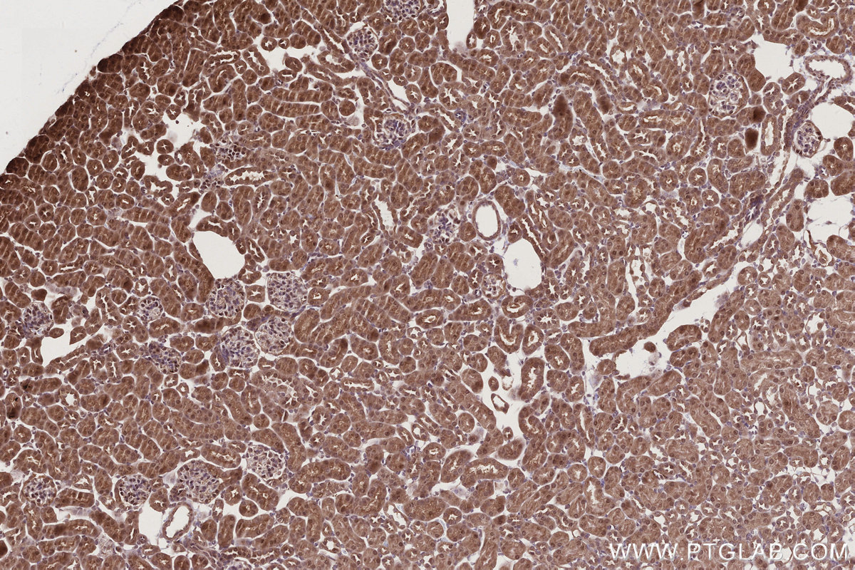 Immunohistochemical analysis of paraffin-embedded mouse kidney tissue slide using KHC2802 (FEM1C IHC Kit).
