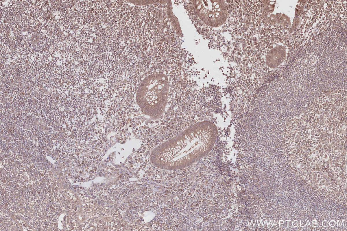 Immunohistochemical analysis of paraffin-embedded human appendicitis tissue slide using KHC2802 (FEM1C IHC Kit).