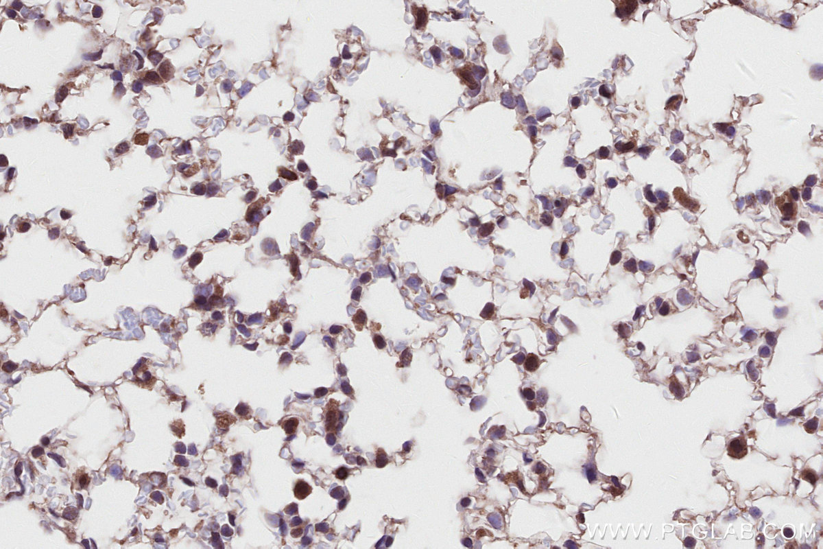 Immunohistochemical analysis of paraffin-embedded mouse lung tissue slide using KHC2802 (FEM1C IHC Kit).