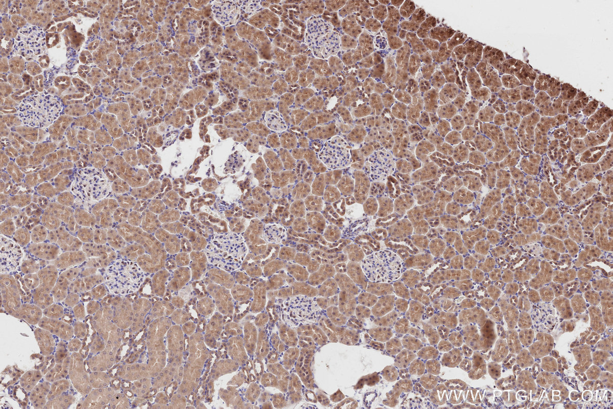 Immunohistochemical analysis of paraffin-embedded rat kidney tissue slide using KHC2802 (FEM1C IHC Kit).