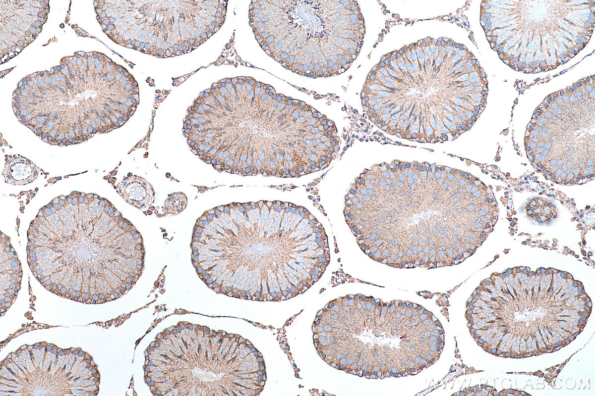 Immunohistochemical analysis of paraffin-embedded rat testis tissue slide using KHC0688 (FERMT2/Kindlin 2 IHC Kit).