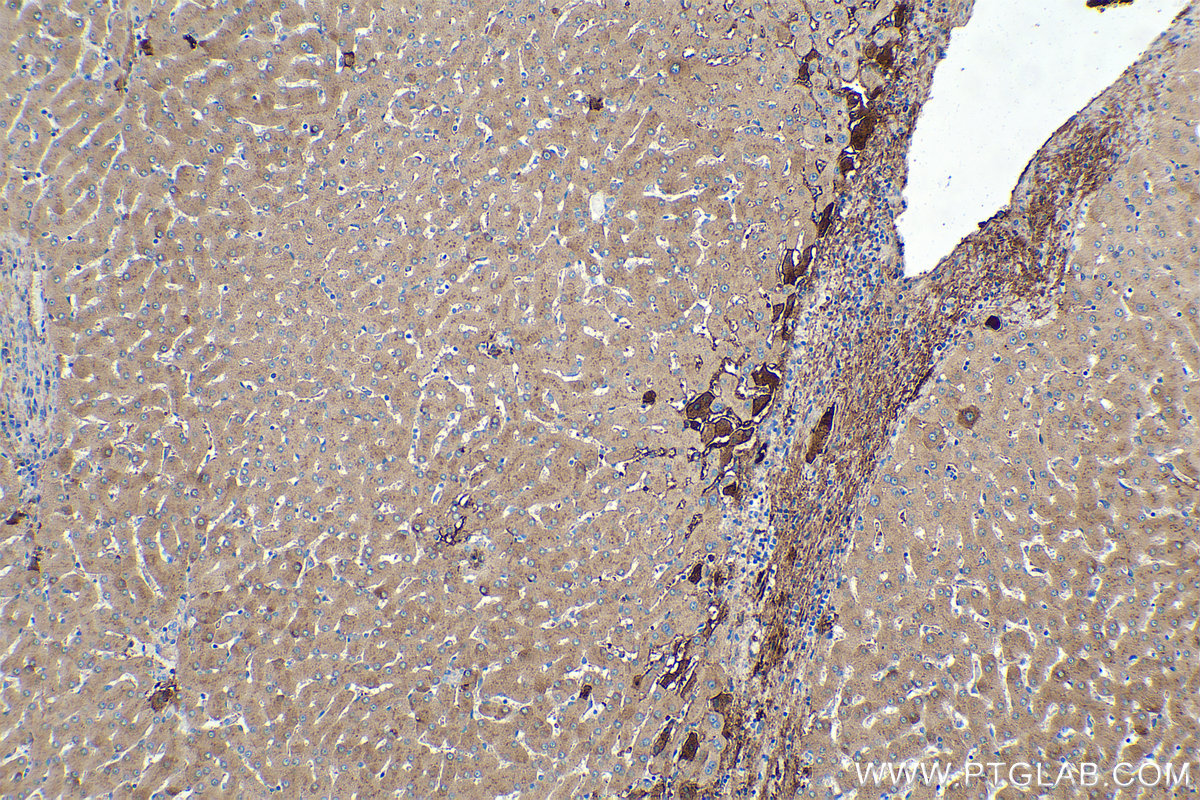 Immunohistochemical analysis of paraffin-embedded human liver tissue slide using KHC0388 (Fibrinogen Beta Chain IHC Kit).