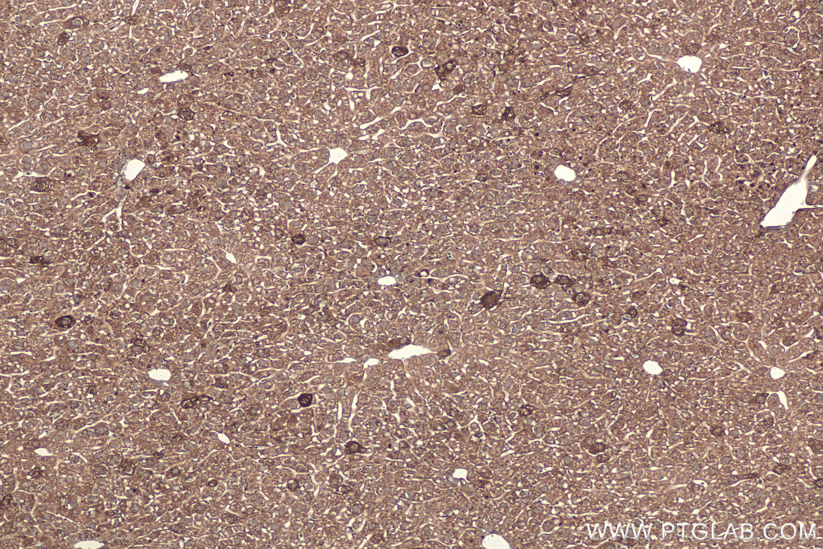 Immunohistochemical analysis of paraffin-embedded mouse liver tissue slide using KHC0388 (Fibrinogen Beta Chain IHC Kit).