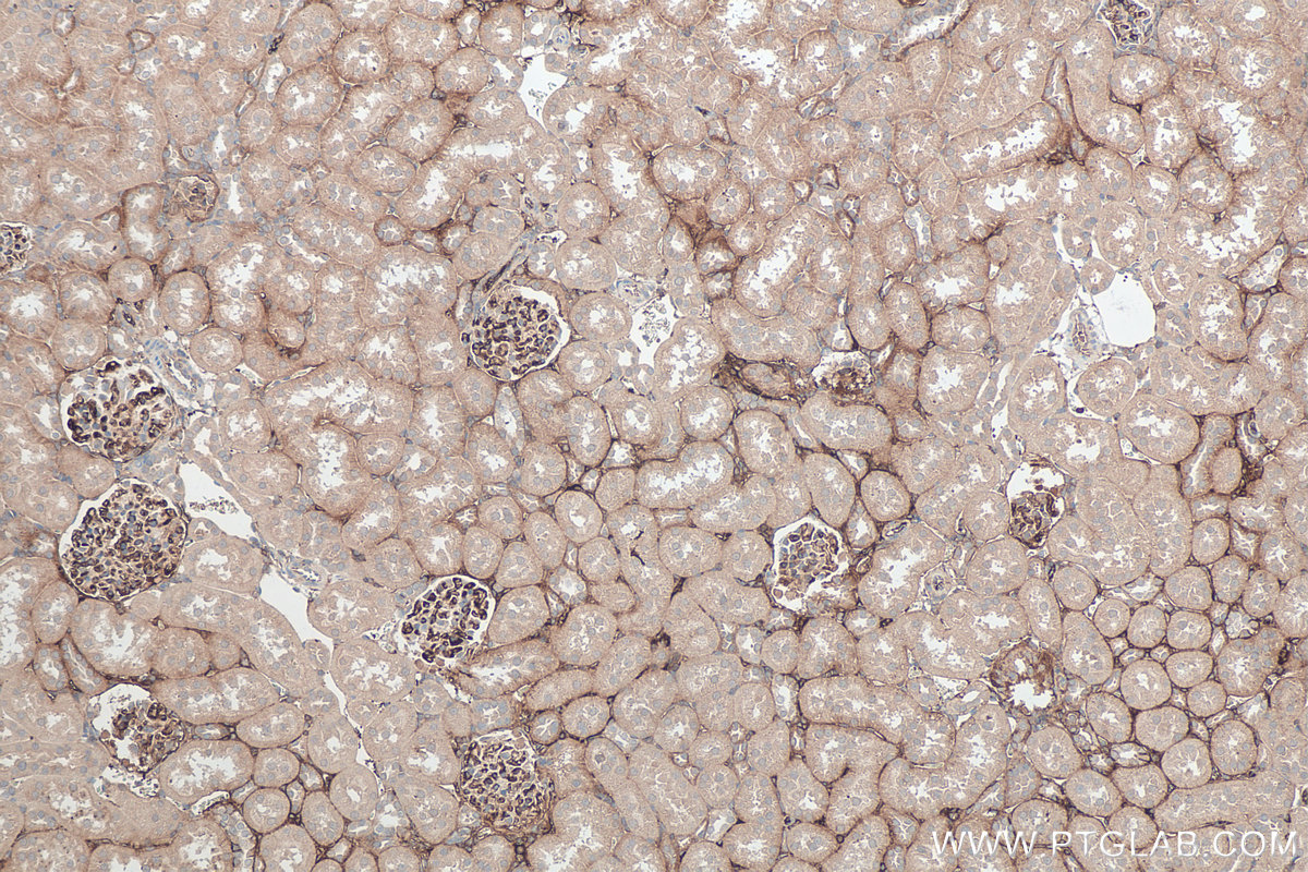 Immunohistochemical analysis of paraffin-embedded rat kidney tissue slide using KHC0388 (Fibrinogen Beta Chain IHC Kit).