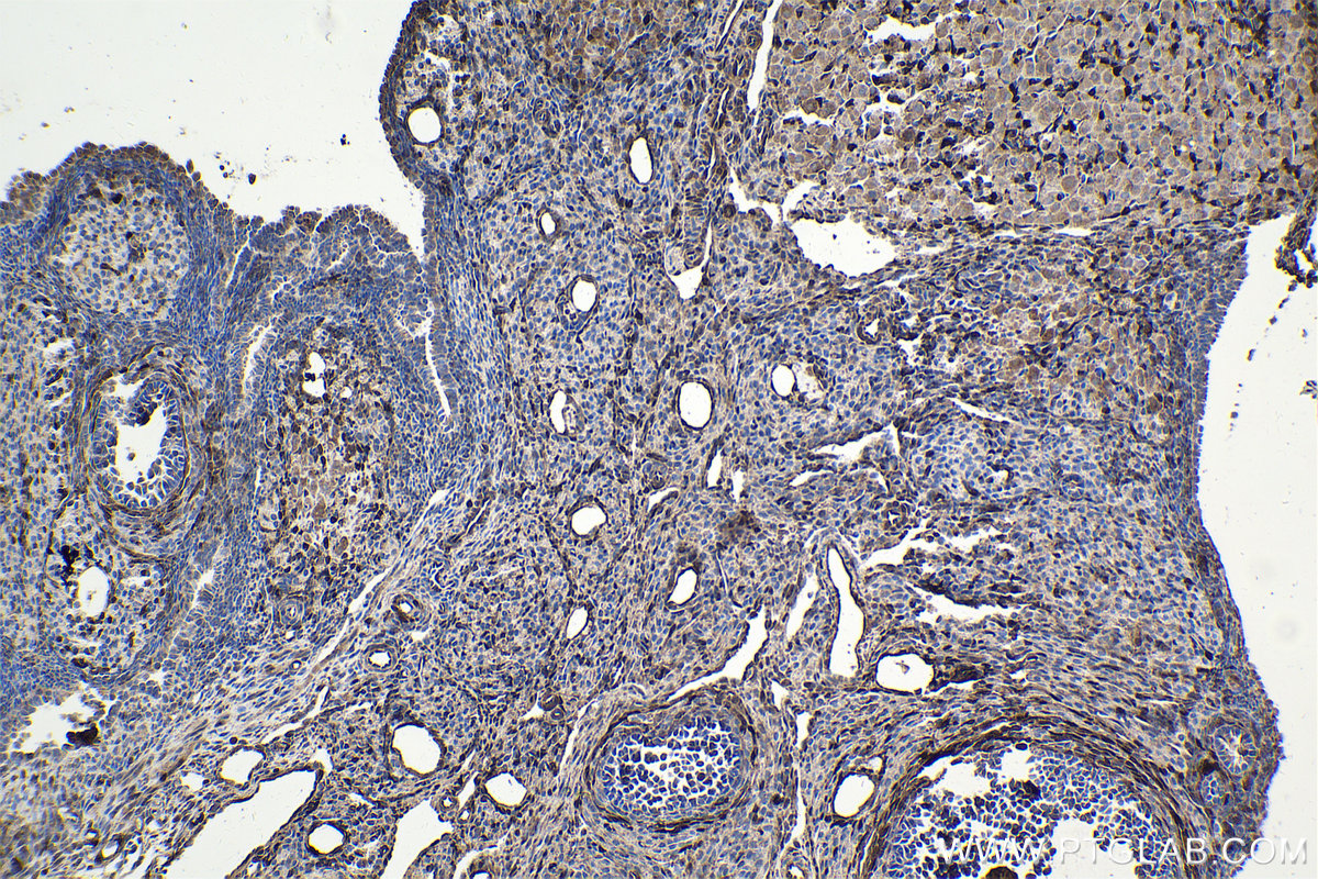 Immunohistochemical analysis of paraffin-embedded rat ovary tissue slide using KHC1727 (FHL2 IHC Kit).