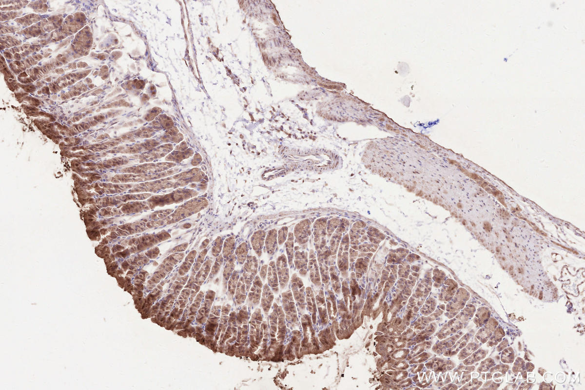 Immunohistochemical analysis of paraffin-embedded mouse stomach tissue slide using KHC2591 (FIGNL1 IHC Kit).
