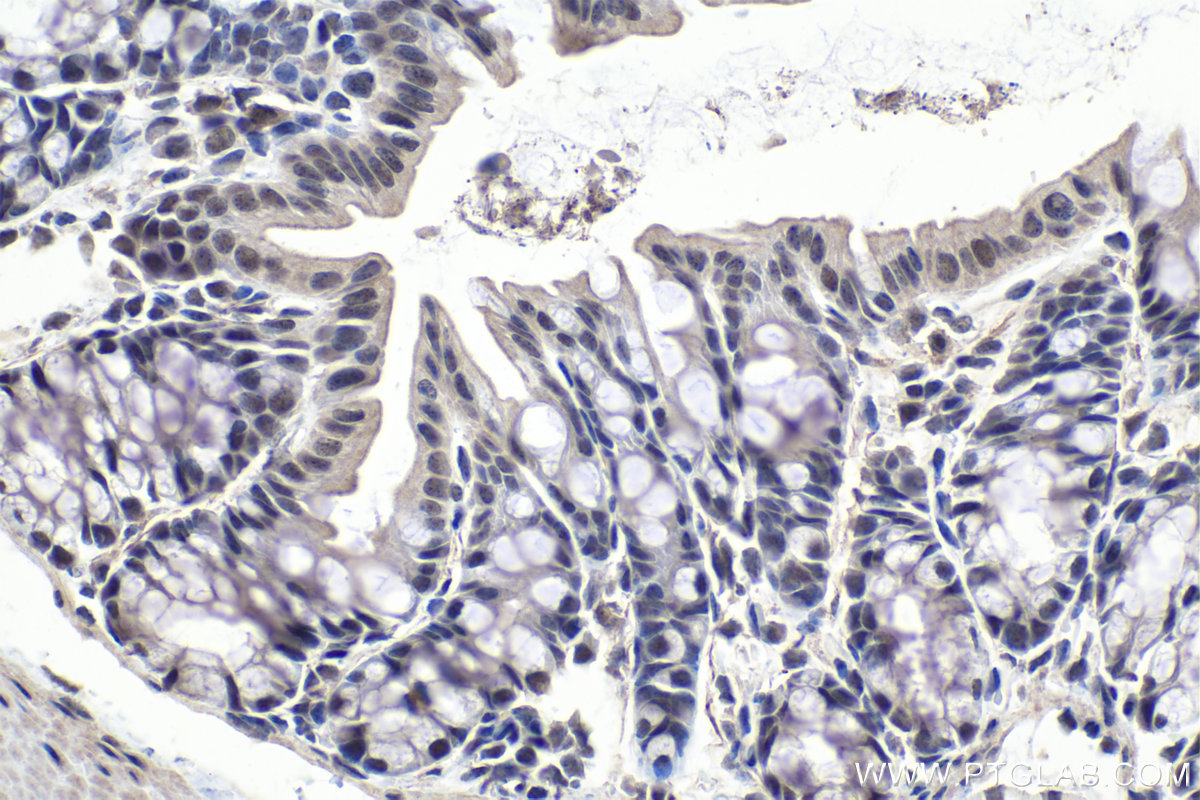 Immunohistochemical analysis of paraffin-embedded mouse colon tissue slide using KHC1018 (FIP1L1 IHC Kit).