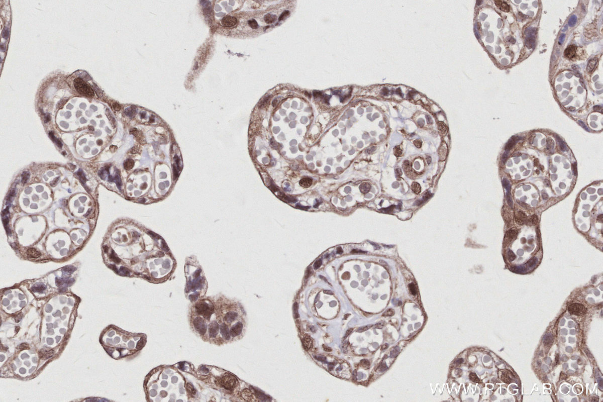 Immunohistochemical analysis of paraffin-embedded human placenta tissue slide using KHC2952 (FIRRM/C1orf112 IHC Kit).
