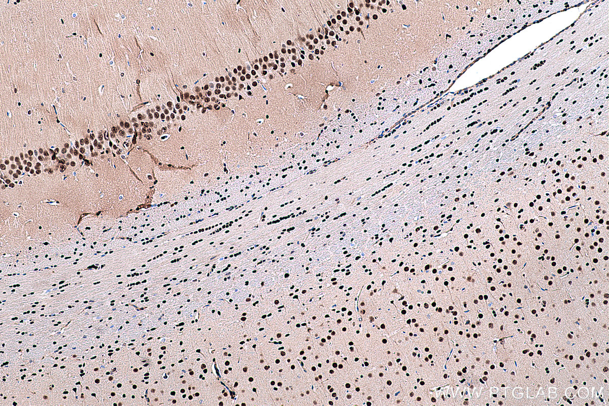 Immunohistochemical analysis of paraffin-embedded rat brain tissue slide using KHC0418 (FKBP5 IHC Kit).