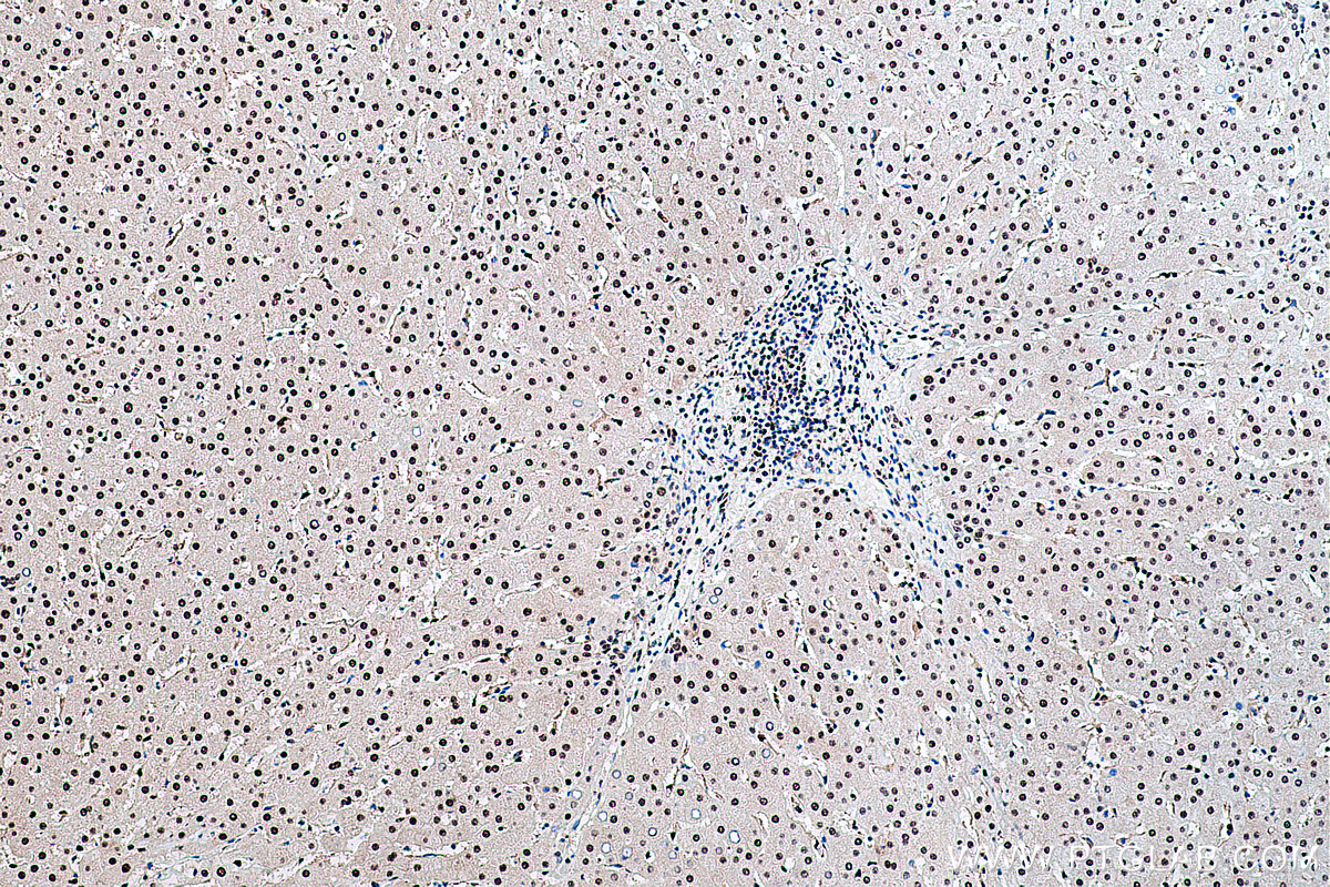 Immunohistochemical analysis of paraffin-embedded human liver tissue slide using KHC0418 (FKBP5 IHC Kit).