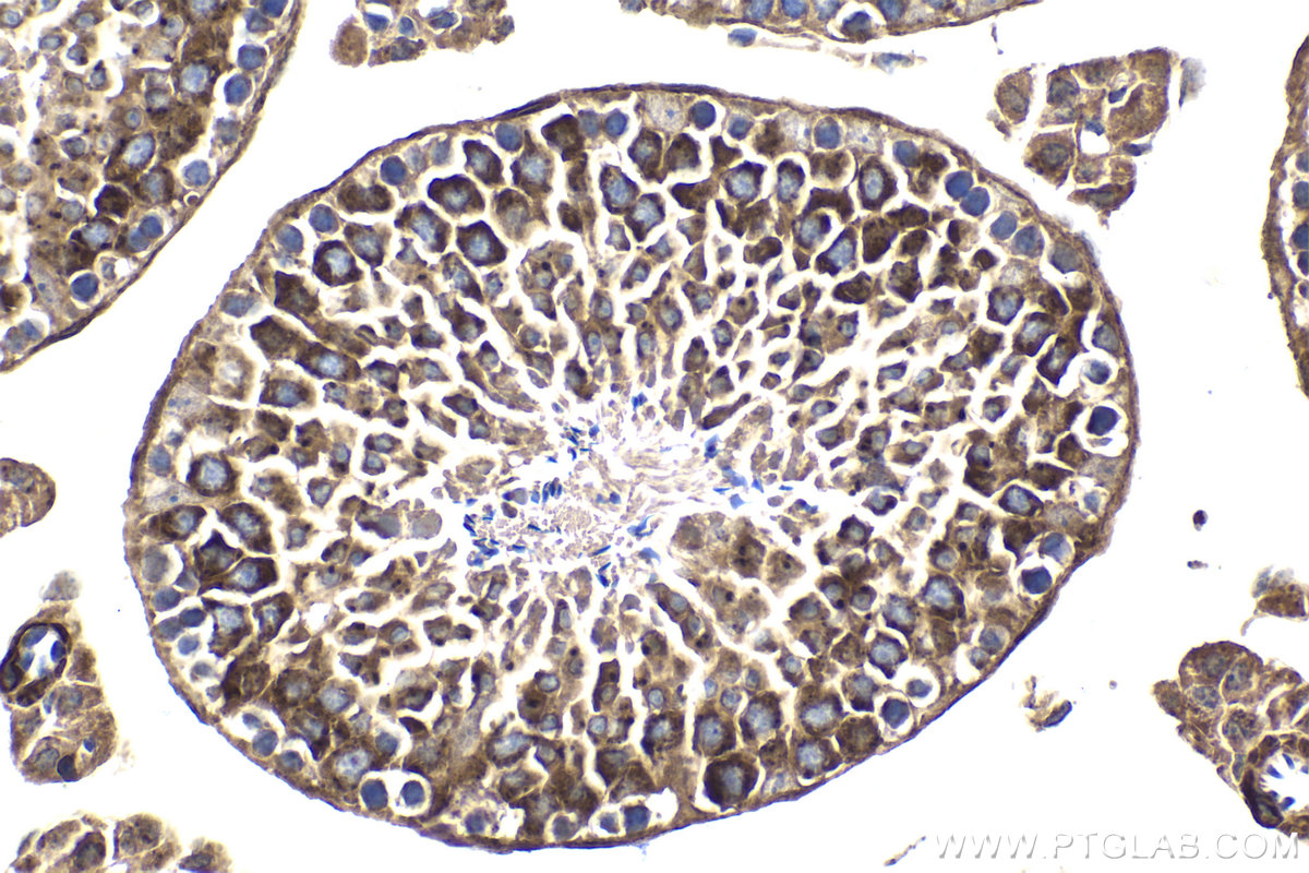 Immunohistochemical analysis of paraffin-embedded mouse testis tissue slide using KHC1839 (FLCN IHC Kit).