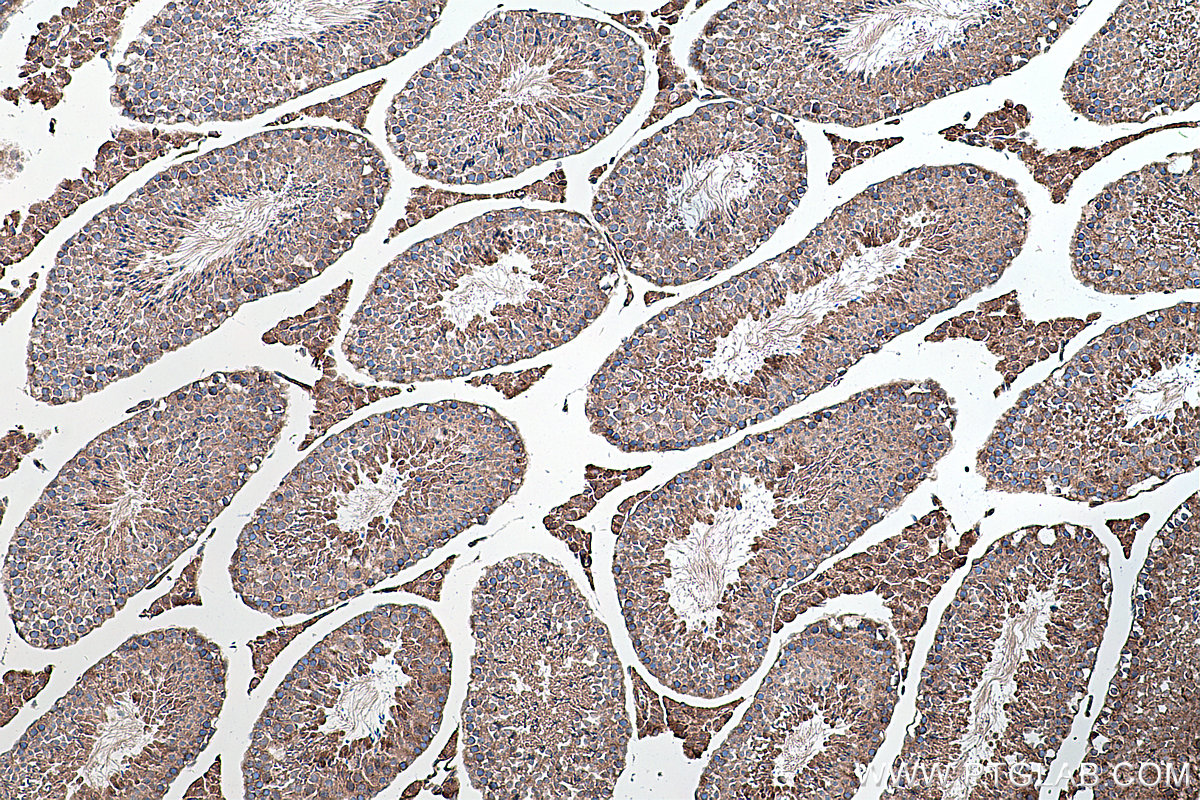 Immunohistochemical analysis of paraffin-embedded mouse testis tissue slide using KHC0217 (VEGFR-1/FLT-1 IHC Kit).