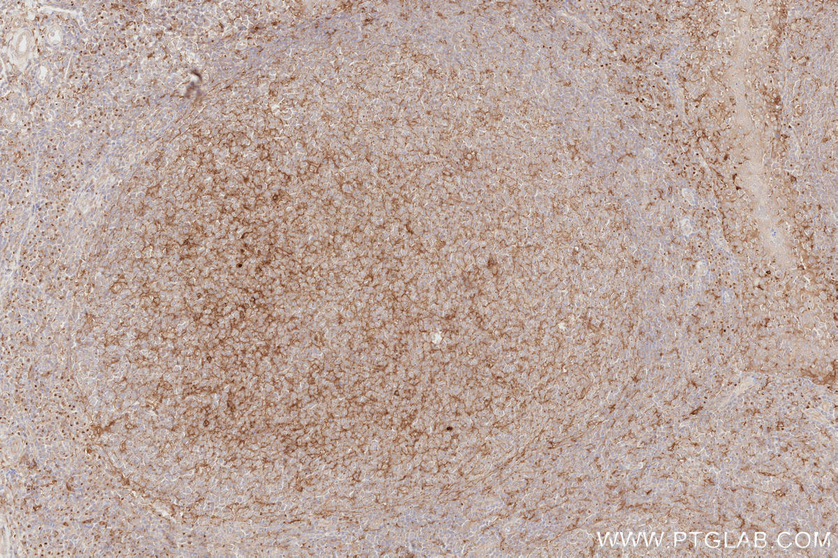 Immunohistochemical analysis of paraffin-embedded human tonsillitis tissue slide using KHC2816 (FMNL2 IHC Kit).