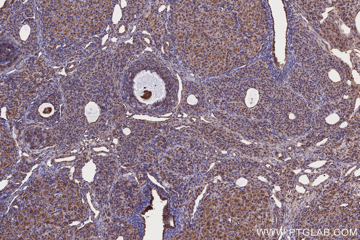 Immunohistochemical analysis of paraffin-embedded rat ovary tissue slide using KHC2646 (FMNL3 IHC Kit).