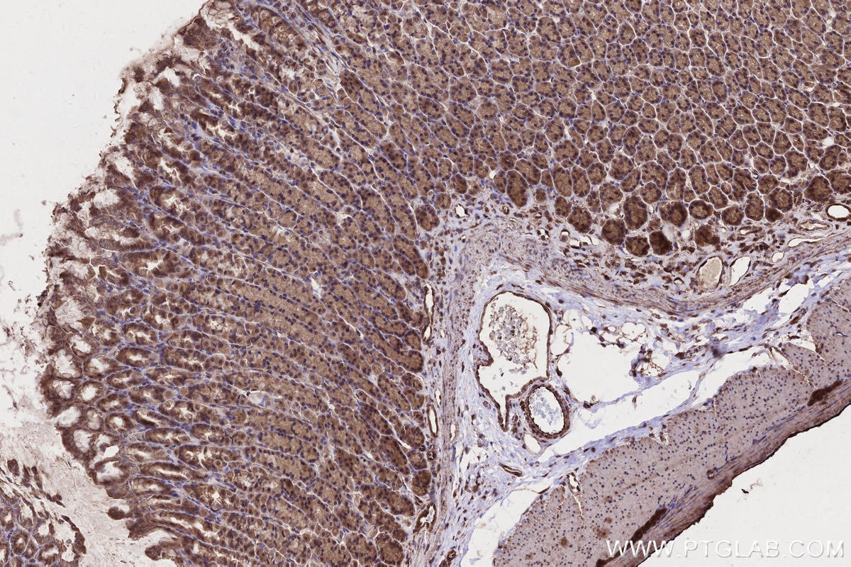 Immunohistochemical analysis of paraffin-embedded rat stomach tissue slide using KHC2646 (FMNL3 IHC Kit).