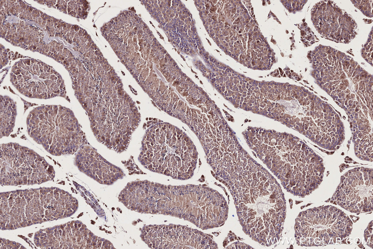 Immunohistochemical analysis of paraffin-embedded mouse testis tissue slide using KHC2727 (FNIP1 IHC Kit).