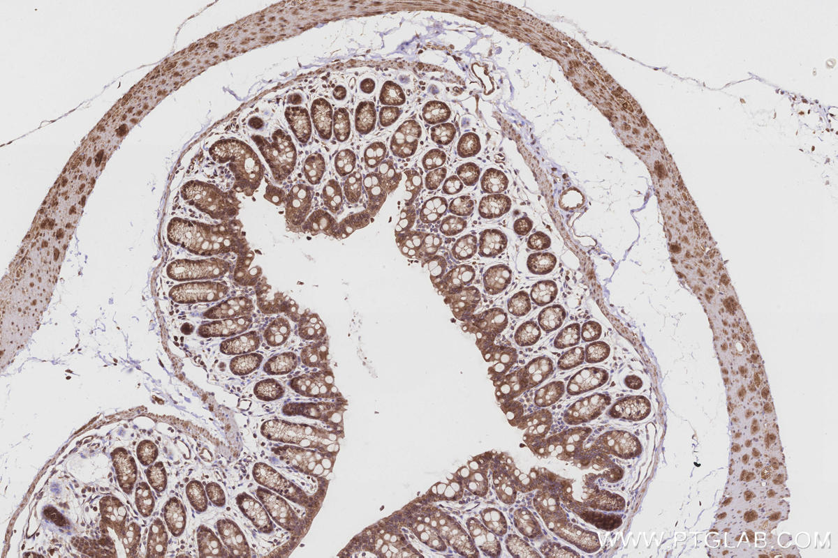 Immunohistochemical analysis of paraffin-embedded mouse colon tissue slide using KHC3216 (FNTA IHC Kit).