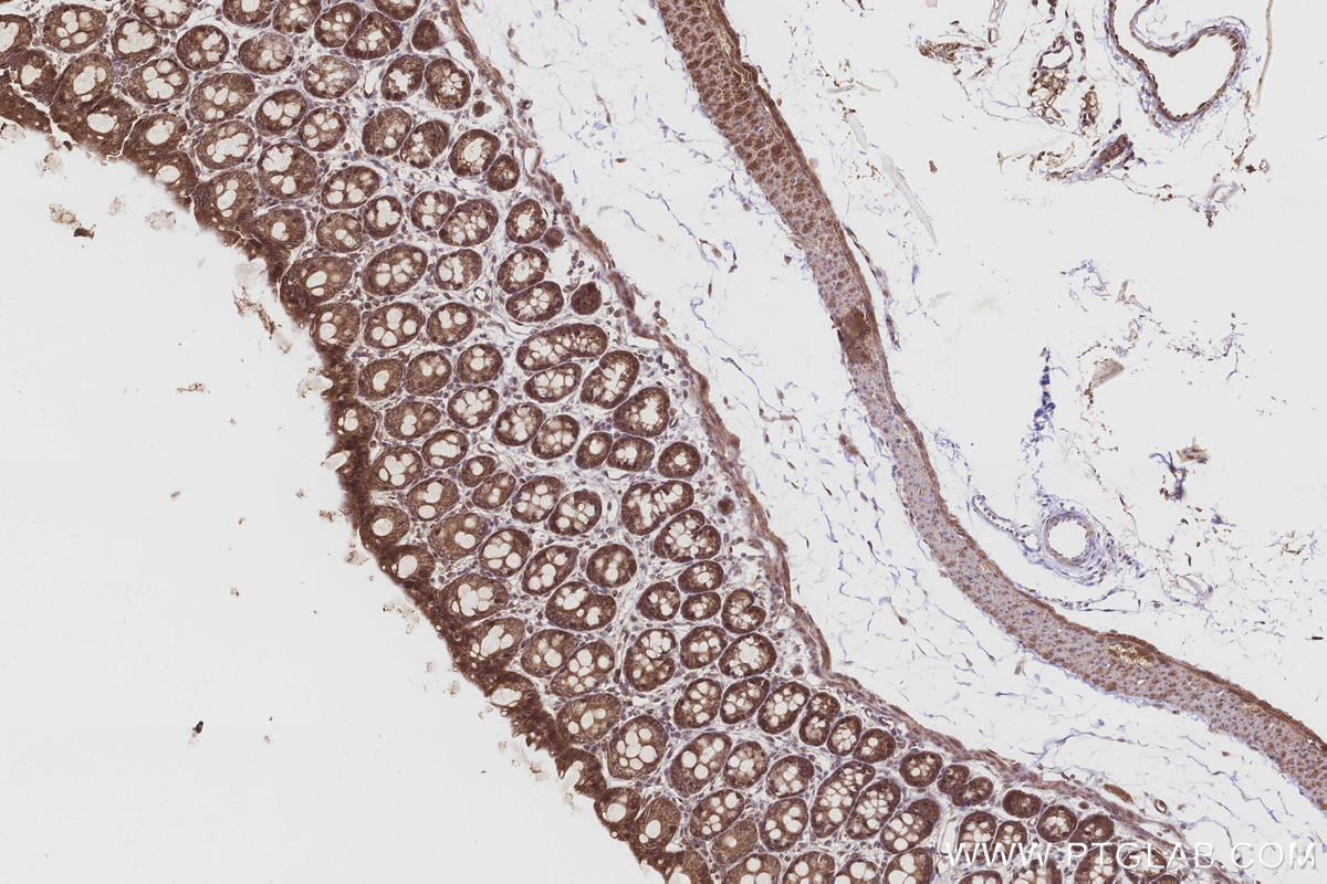 Immunohistochemical analysis of paraffin-embedded rat colon tissue slide using KHC3216 (FNTA IHC Kit).