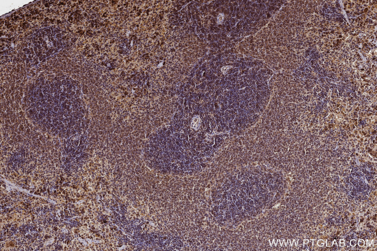 Immunohistochemical analysis of paraffin-embedded rat spleen tissue slide using KHC3217 (FNTB IHC Kit).