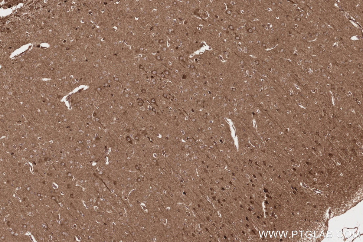 Immunohistochemical analysis of paraffin-embedded rat brain tissue slide using KHC3217 (FNTB IHC Kit).