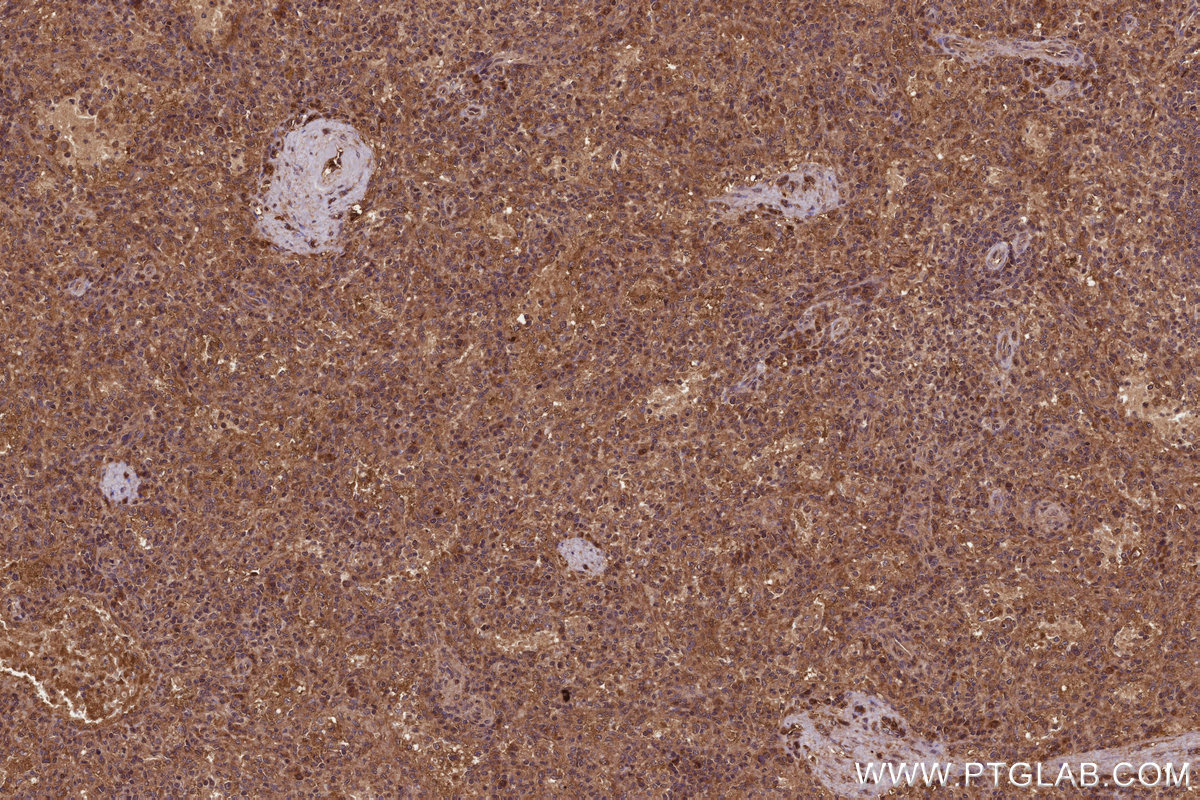 Immunohistochemical analysis of paraffin-embedded human spleen tissue slide using KHC3217 (FNTB IHC Kit).