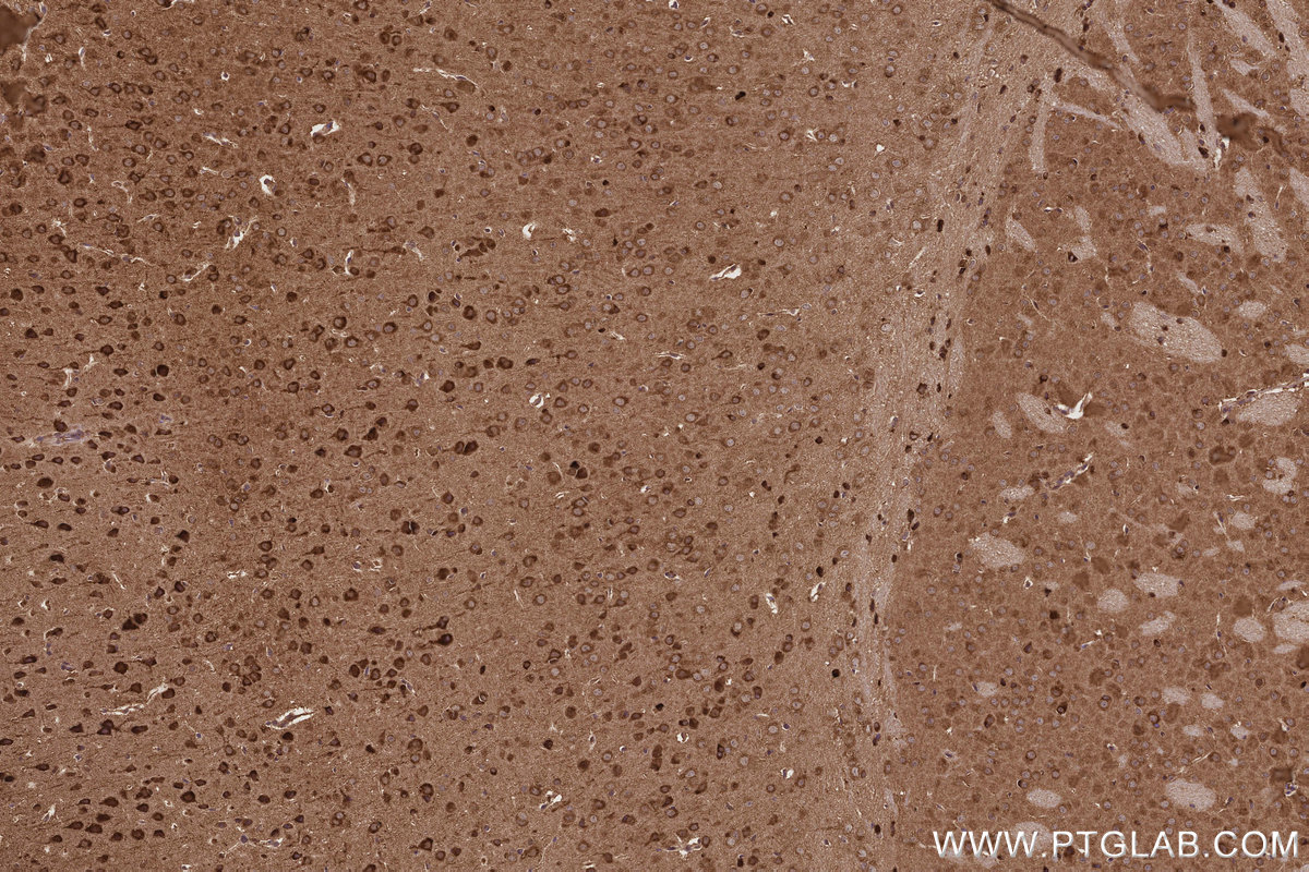 Immunohistochemical analysis of paraffin-embedded mouse brain tissue slide using KHC3217 (FNTB IHC Kit).