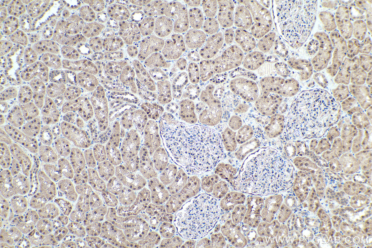 Immunohistochemical analysis of paraffin-embedded human kidney tissue slide using KHC0328 (FOXO1 IHC Kit).