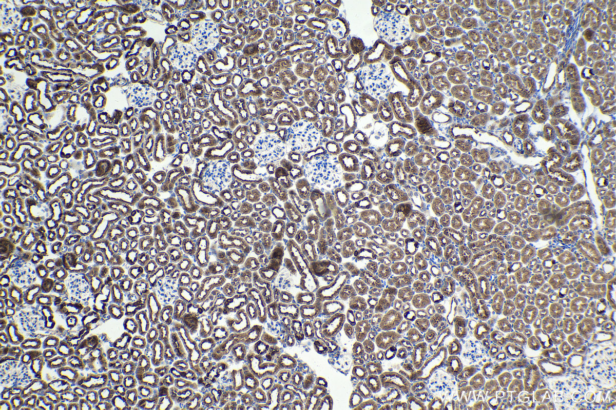 Immunohistochemical analysis of paraffin-embedded mouse kidney tissue slide using KHC1656 (FOXO4 IHC Kit).