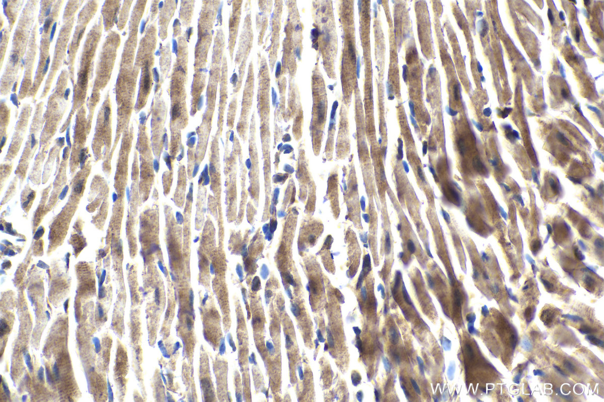 Immunohistochemical analysis of paraffin-embedded mouse heart tissue slide using KHC1656 (FOXO4 IHC Kit).