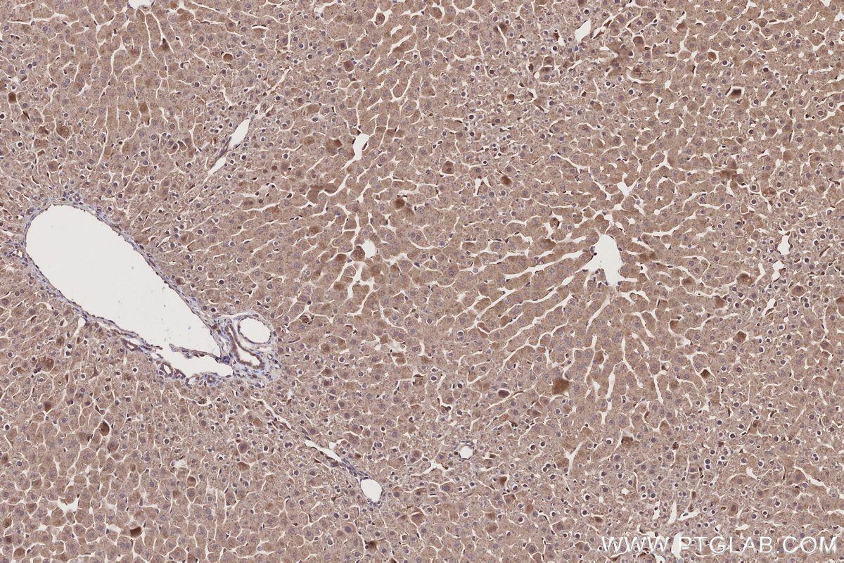 Immunohistochemical analysis of paraffin-embedded rat liver tissue slide using KHC2731 (FRS2 IHC Kit).