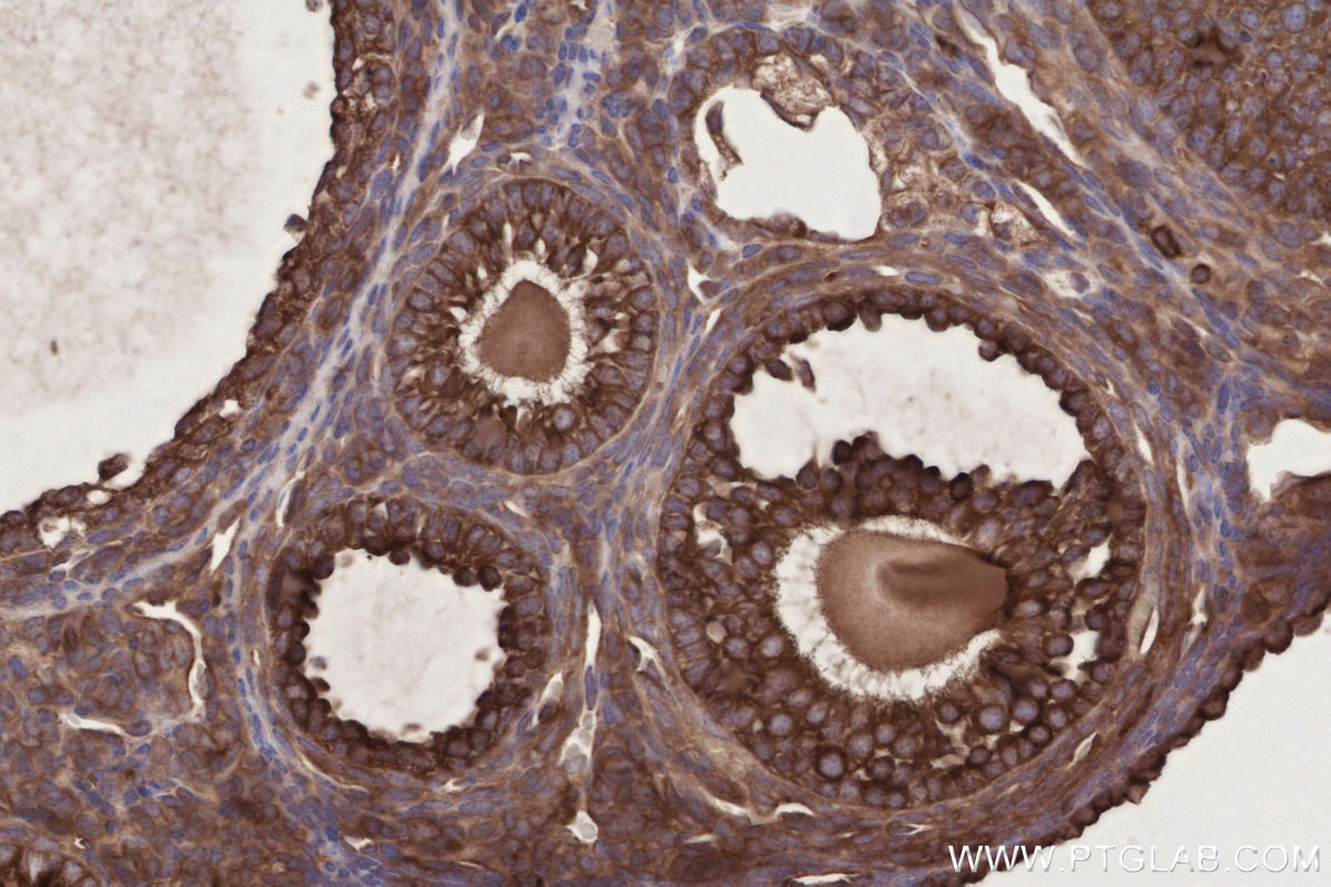 Immunohistochemical analysis of paraffin-embedded mouse ovary tissue slide using KHC2731 (FRS2 IHC Kit).