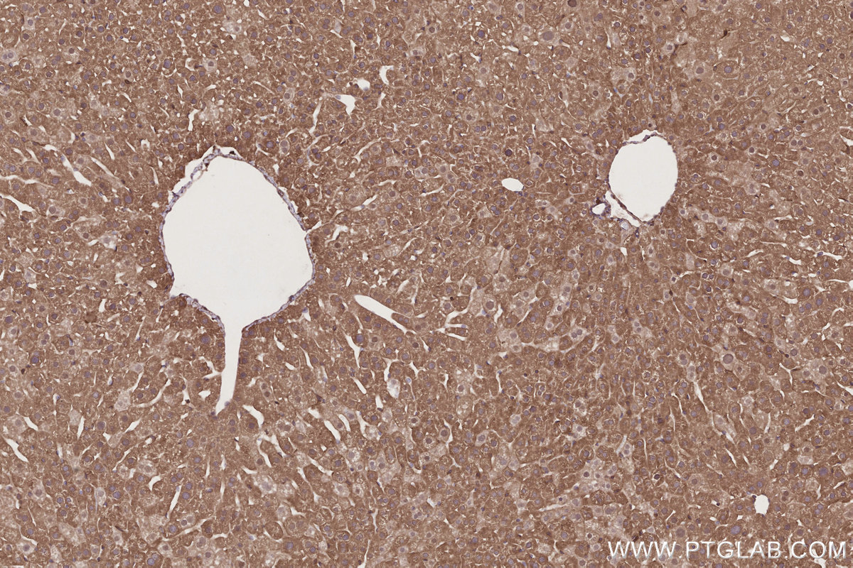 Immunohistochemical analysis of paraffin-embedded mouse liver tissue slide using KHC2731 (FRS2 IHC Kit).