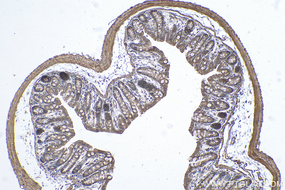 Immunohistochemical analysis of paraffin-embedded mouse colon tissue slide using KHC0794 (FSTL1 IHC Kit).