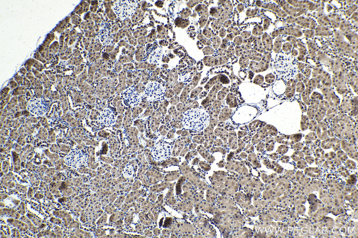 Immunohistochemical analysis of paraffin-embedded rat kidney tissue slide using KHC1498 (FSTL3 IHC Kit).