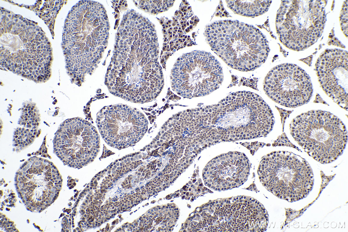 Immunohistochemical analysis of paraffin-embedded mouse testis tissue slide using KHC0153 (FTO IHC Kit).