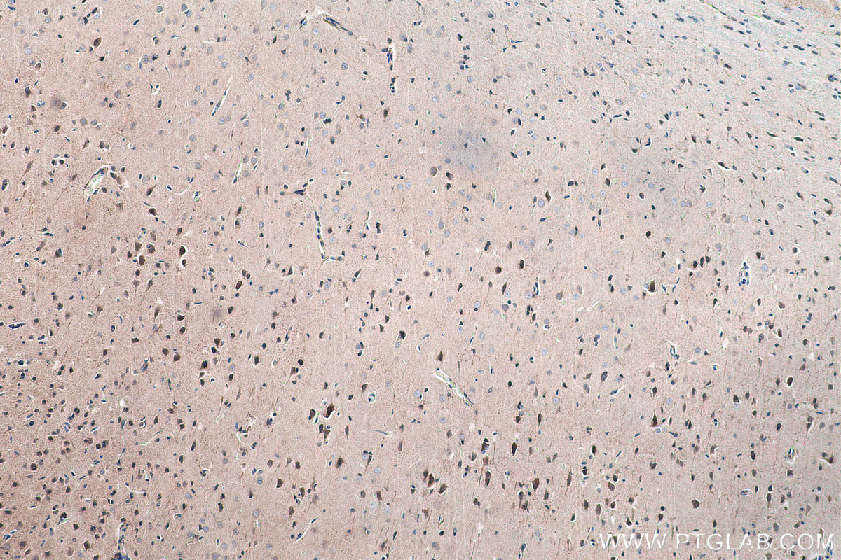 Immunohistochemical analysis of paraffin-embedded rat brain tissue slide using KHC0181 (FTSJ1 IHC Kit).