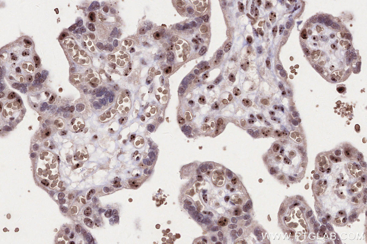 Immunohistochemical analysis of paraffin-embedded human placenta tissue slide using KHC2657 (FTSJ3 IHC Kit).