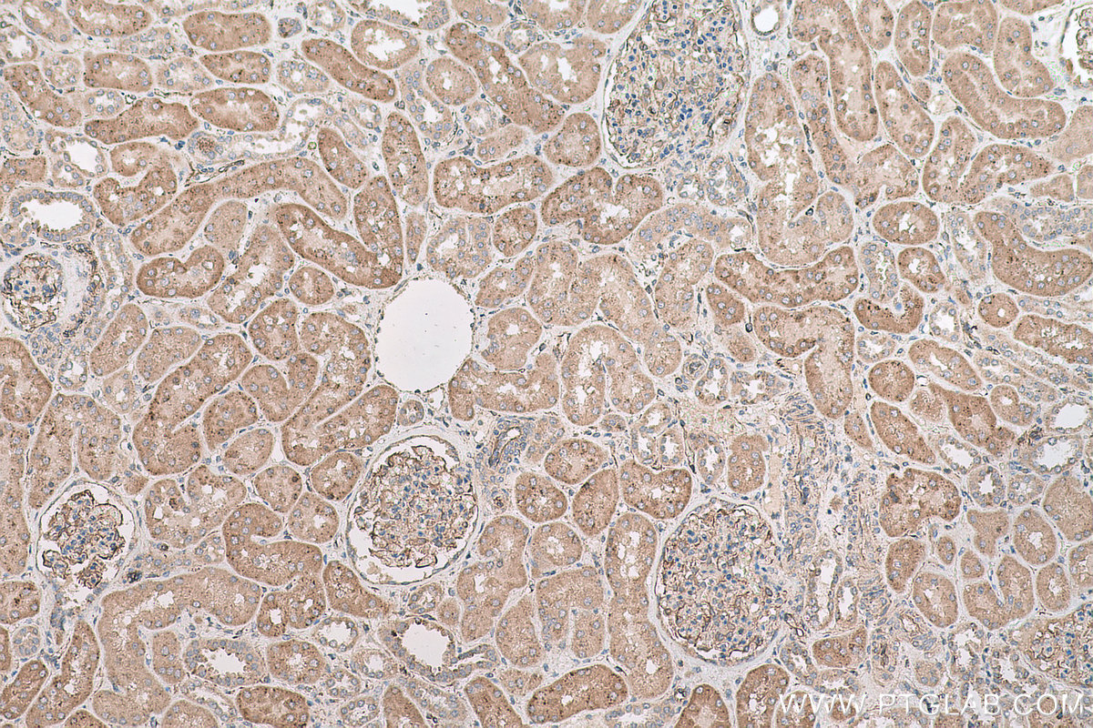 Immunohistochemical analysis of paraffin-embedded human kidney tissue slide using KHC0766 (FUCA1 IHC Kit).