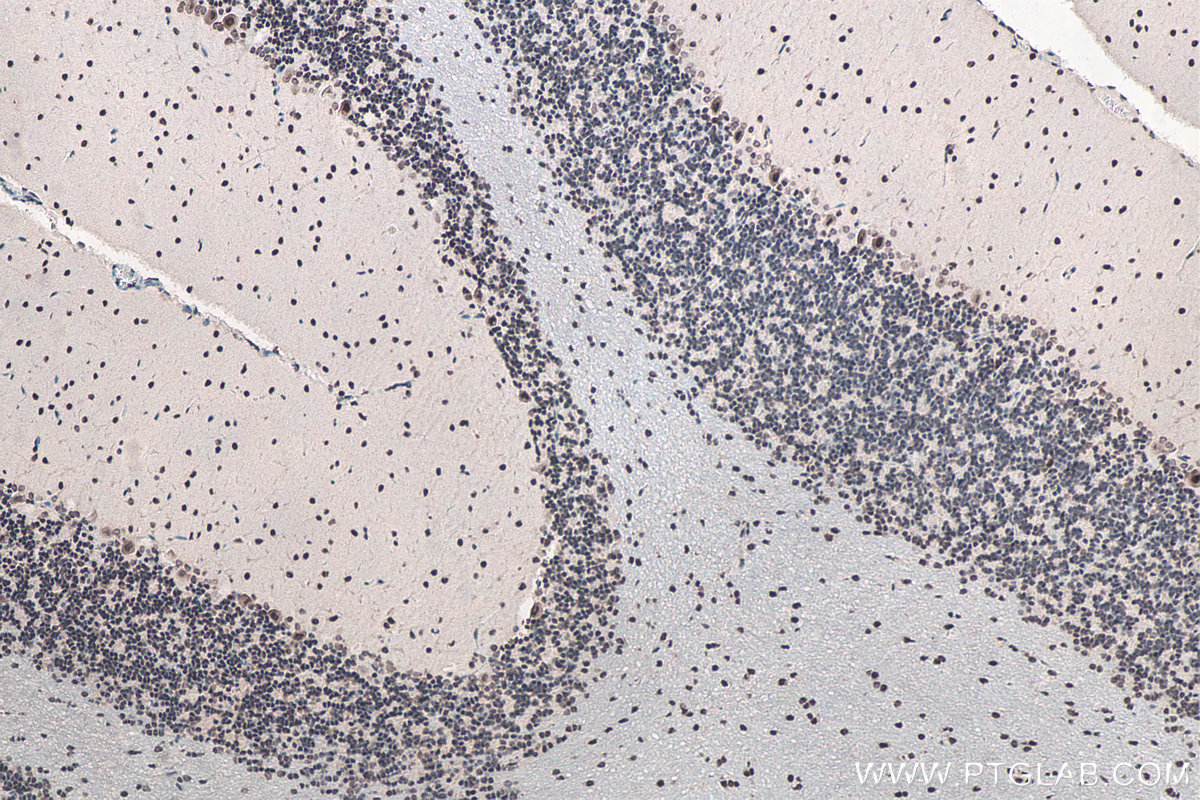 Immunohistochemical analysis of paraffin-embedded rat cerebellum tissue slide using KHC0057 (FUS/TLS IHC Kit).