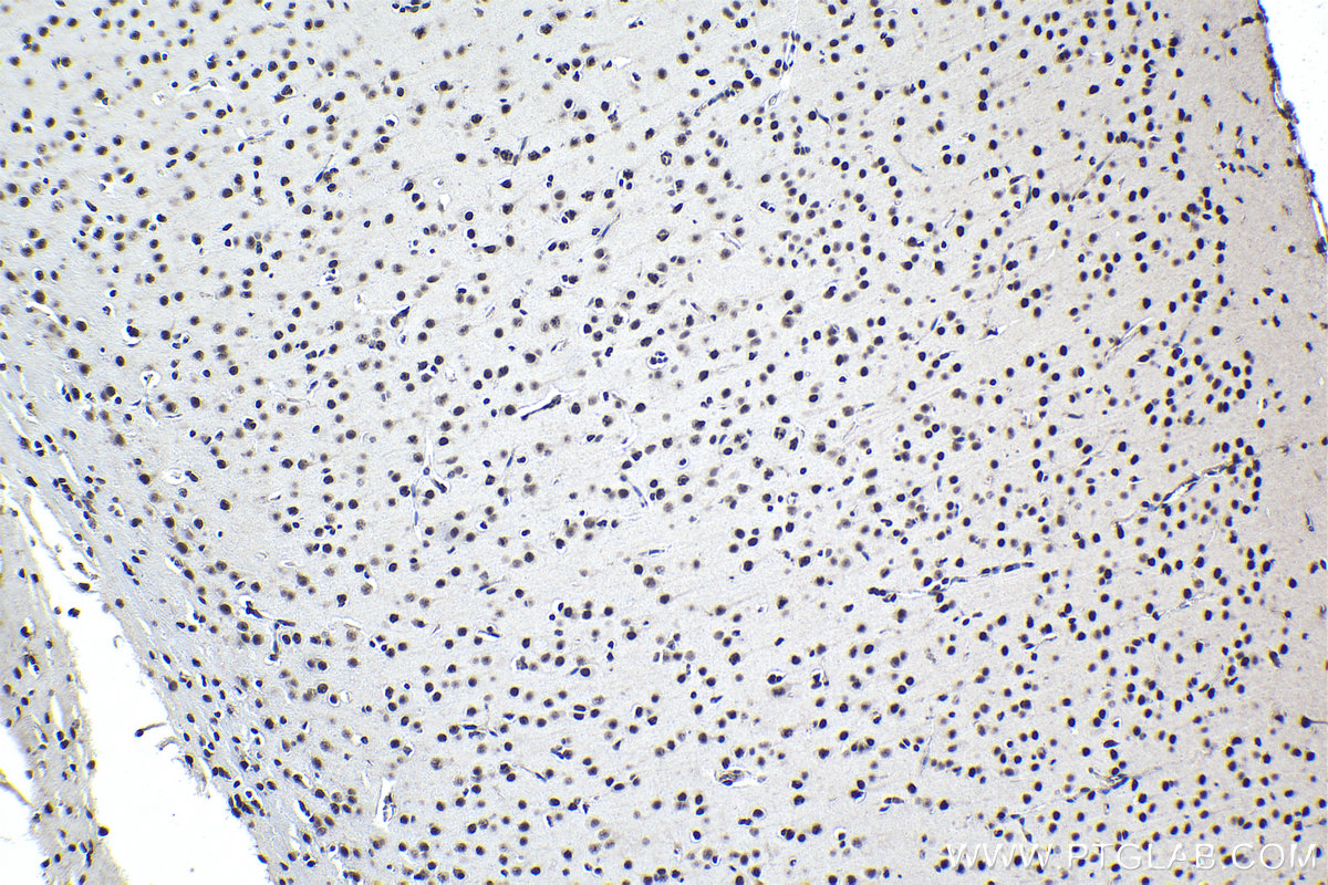 Immunohistochemical analysis of paraffin-embedded rat brain tissue slide using KHC0937 (FUS/TLS IHC Kit).